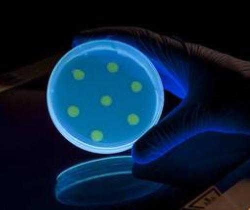 Zymoseptoria - photo credit Rothamsted Research